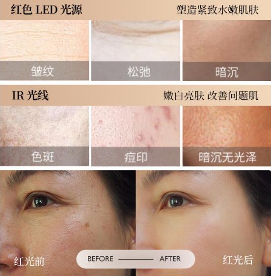 時(shí)光之謎美容儀,將光療抗衰新技術(shù)帶入百姓生活