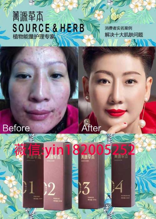 箐源草本臭水代理價(jià)格表,多少錢(qián)一盒?