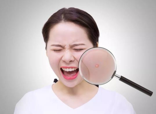 鼻子上長膿包型痘痘可以擠嗎?兩眉中間長痘怎么調(diào)理?