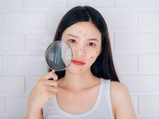 青春痘疫苗在臨床實(shí)踐中有什么作用?青春痘疫苗可以打嗎