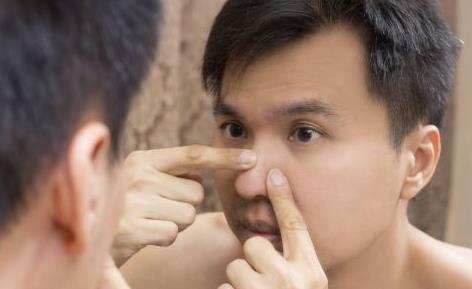 讓你快速祛痘的祛痘方法 關(guān)于痘痘你不知道的事