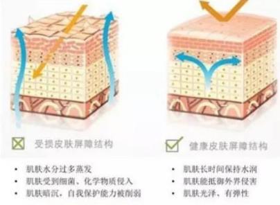 臉上有紅血絲怎么辦,臉上紅血絲怎么治