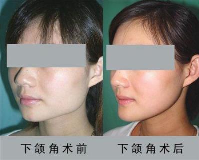 宿州陽光整形醫(yī)院怎樣 給你最美的顏值
