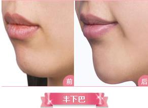 宿州陽光整形醫(yī)院怎樣 給你最美的顏值