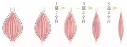 伊美爾愛(ài)康醫(yī)院自體脂肪填充效果好不好?
