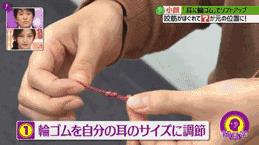 伊美爾愛(ài)康醫(yī)院自體脂肪填充效果好不好?