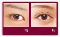 樂山經(jīng)緯整形醫(yī)院技術(shù)好不好 為你重新定義美麗