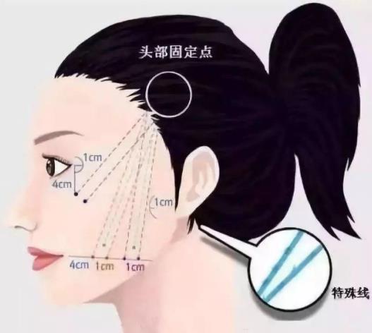 昆明藝星整形醫(yī)院可靠么 素顏女神