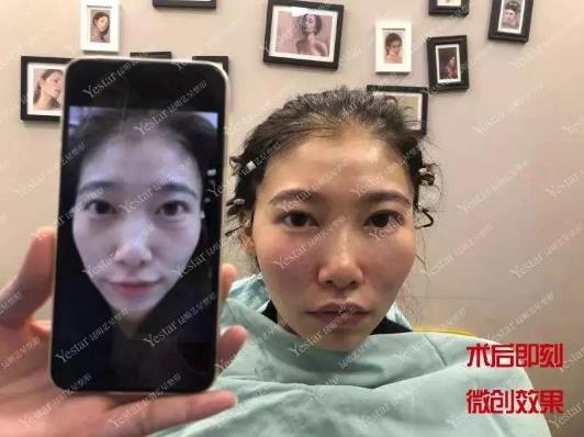 昆明藝星整形醫(yī)院可靠么 素顏女神
