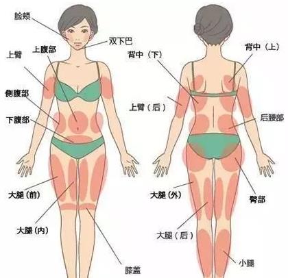吸脂術(shù)會反彈嗎 吸脂的后遺癥是什么 吸脂術(shù)不能替代科學(xué)減肥