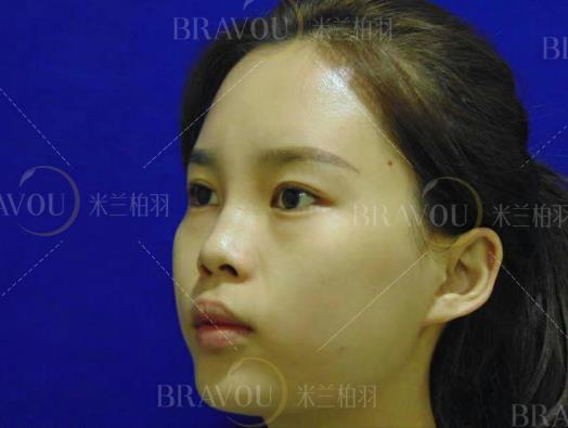 深圳米蘭柏羽專家王志東怎么樣 讓您重拾自信