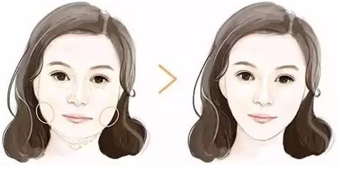 鄭州美萊整形醫(yī)院的評(píng)價(jià) 瘦臉針輕松瘦臉