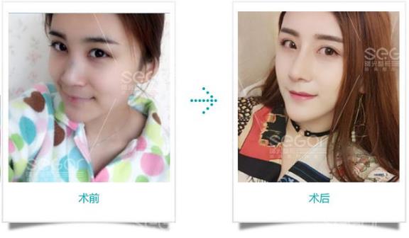 常州曙光醫(yī)院效果怎么樣?看她們就知道了!