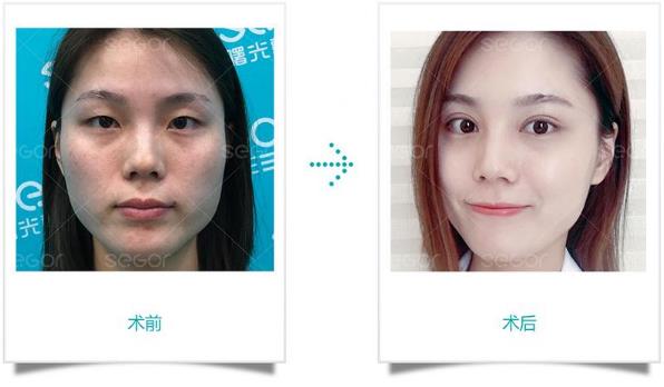 常州曙光醫(yī)院效果怎么樣?看她們就知道了!