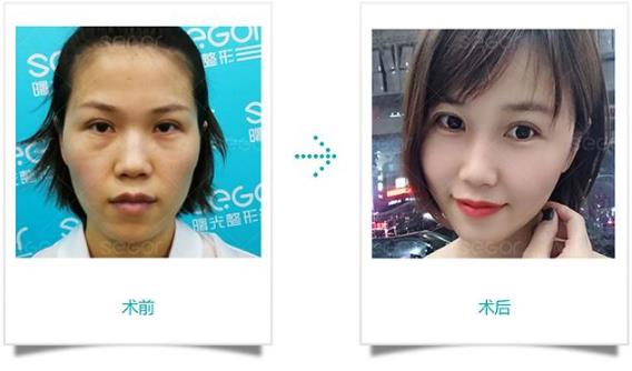 常州曙光醫(yī)院效果怎么樣?看她們就知道了!