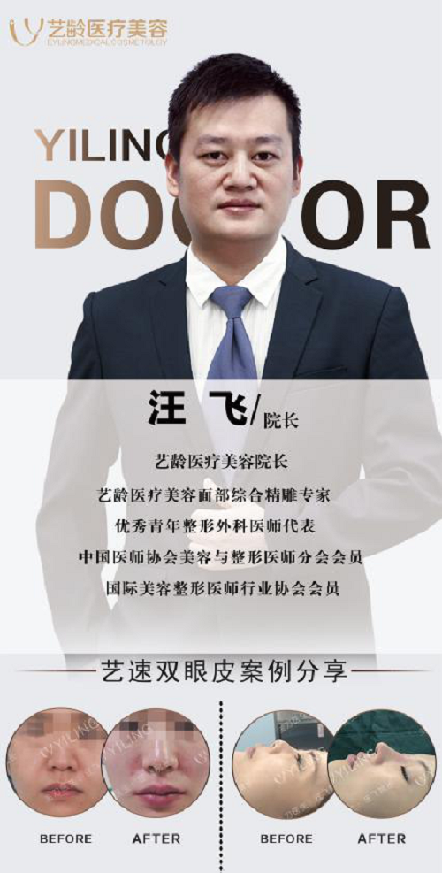 貴陽藝齡汪飛院長(zhǎng)揭秘為什么鼻整形顯假 打造精致自然鼻