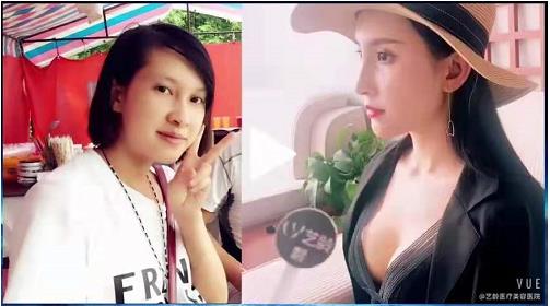 貴陽藝齡汪飛院長(zhǎng)揭秘為什么鼻整形顯假 打造精致自然鼻