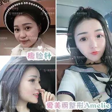 鄭州愛(ài)美麗醫(yī)院,有一種肉毒素,打了“它”,男友比原來(lái)更加愛(ài)你了!