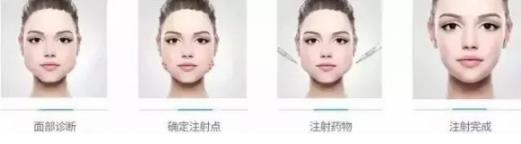 鄭州愛(ài)美麗醫(yī)院,有一種肉毒素,打了“它”,男友比原來(lái)更加愛(ài)你了!