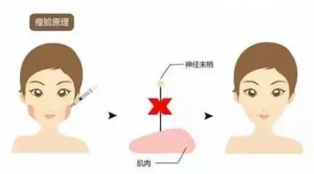 鄭州愛(ài)美麗醫(yī)院,有一種肉毒素,打了“它”,男友比原來(lái)更加愛(ài)你了!