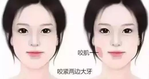 鄭州愛(ài)美麗醫(yī)院,有一種肉毒素,打了“它”,男友比原來(lái)更加愛(ài)你了!