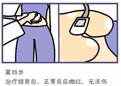 武漢藝星整形醫(yī)院:6月22-28日酷塑減脂專場(chǎng),讓你輕輕松松的減肥!