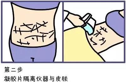 武漢藝星整形醫(yī)院:6月22-28日酷塑減脂專場(chǎng),讓你輕輕松松的減肥!