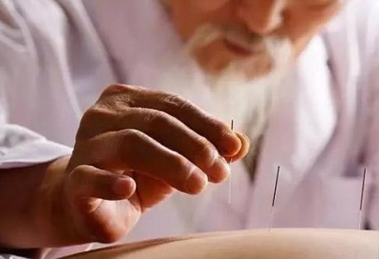 針灸減肥做多久最好?針灸減肥時間越長越好嗎?