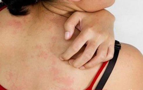 為什么皮膚瘙癢“越撓越癢”,“越癢越撓”再撓剁手