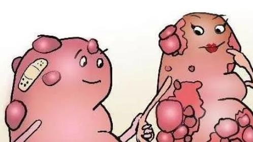 得了腎結(jié)石怎么辦?腎結(jié)石需要注意什么?患腎結(jié)石的原因