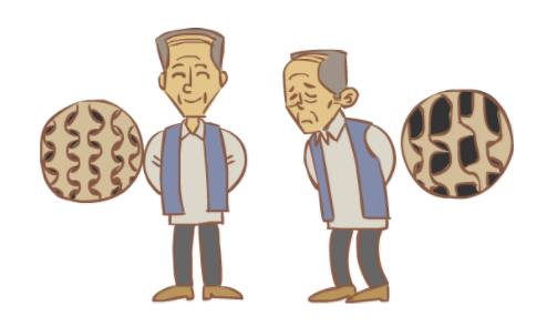 骨質(zhì)疏松的癥狀有哪些,骨質(zhì)疏松怎么辦?如何預(yù)防骨質(zhì)疏松