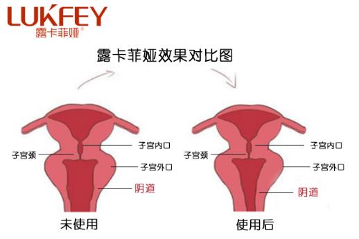 私護(hù)產(chǎn)品哪個效果最好最正規(guī)?這款產(chǎn)品受歡迎!