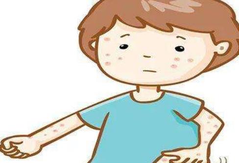 毛囊炎有哪些危害?患毛囊炎有哪些注意事項(xiàng)及護(hù)理?