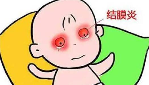 結(jié)膜炎有哪些治療方法?患結(jié)膜炎需要注意什么?