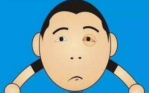 患結膜炎需要做哪些檢查?患結膜炎怎么護理?