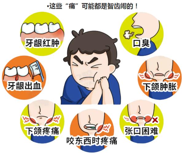 全民愛牙公益行動(dòng)告訴您這些牙齒疼痛是智齒鬧的