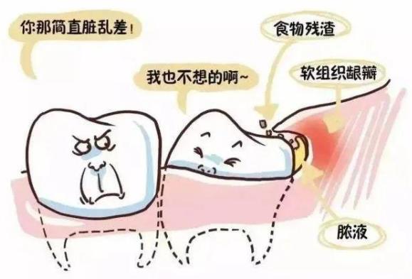 全民愛牙公益行動(dòng)告訴您這些牙齒疼痛是智齒鬧的