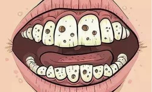 牙垢和牙石有什么區(qū)別?祛除牙垢的辦法有哪些?
