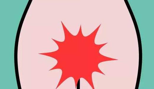 外陰瘙癢會引起哪些并發(fā)癥?外陰瘙癢需要注意什么?