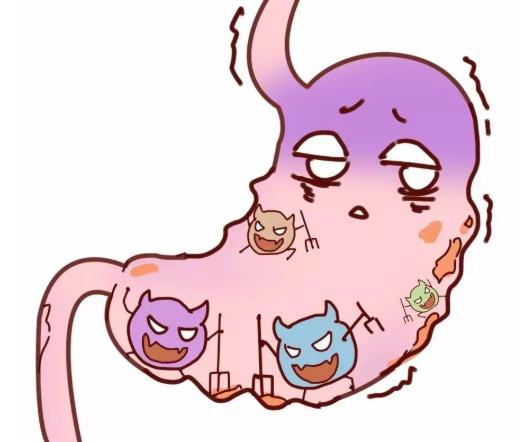 胃潰瘍的病因有哪些?胃潰瘍的癥狀有哪些