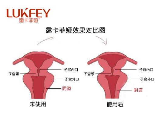 露卡菲婭藥店有賣嗎?露卡菲婭官方購買途徑!