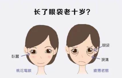 京典麗園去眼袋怎么樣 達到分型改善不開刀去眼袋