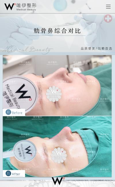 廣州唯伊整形怎么樣 品質(zhì)服務(wù)讓你安心變美