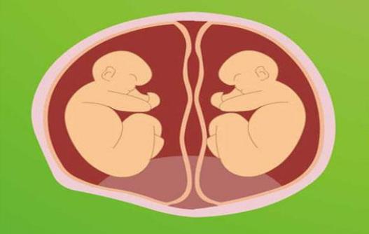 什么是異卵雙胞胎?異卵雙胞胎有哪些風(fēng)險(xiǎn)?