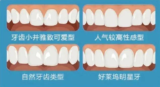 廣東省全民愛牙行動(dòng) 給大家講一下瓷貼面美學(xué)修復(fù)~