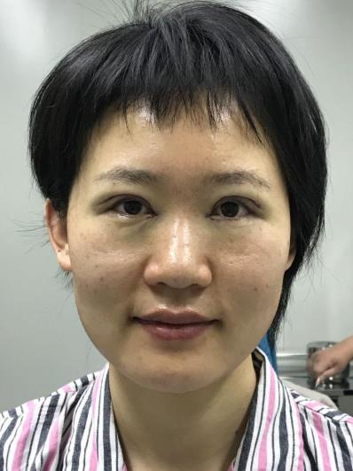 北京麗星翼美整形醫(yī)院雙眼皮技術(shù)怎么樣 魏志香院長獨特魅力自信打造