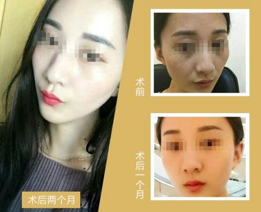 蜂巢皮秒祛斑是什么原理?江門夢想整形醫(yī)院電話,江門夢想整形技術(shù)好嗎