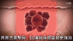 蜂巢皮秒祛斑是什么原理?江門夢想整形醫(yī)院電話,江門夢想整形技術(shù)好嗎