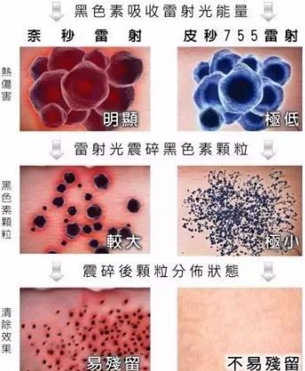 蜂巢皮秒祛斑是什么原理?江門夢想整形醫(yī)院電話,江門夢想整形技術(shù)好嗎