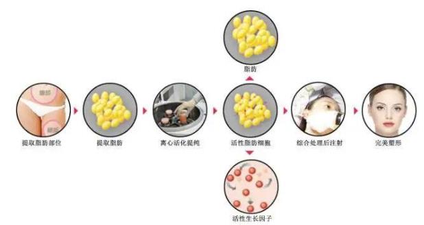 云南銅雀臺整形趙蘭明主任脂肪填充如何 專業(yè)提供整形美容服務(wù)